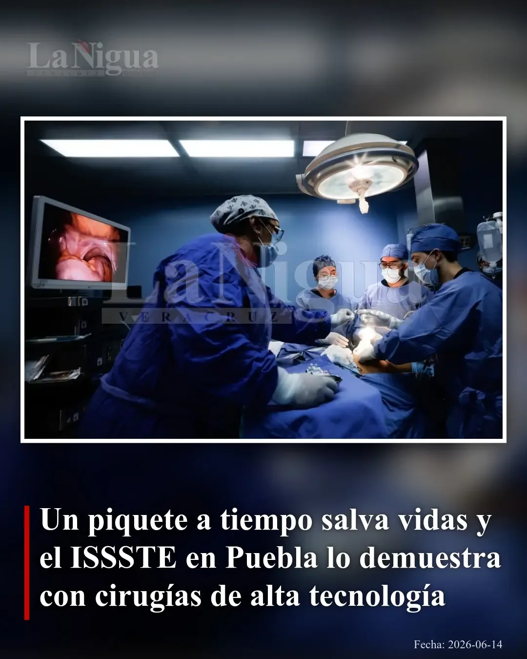 Cirugías laparoscópicas en el ISSSTE de Puebla mejoran detección y tratamiento del cáncer de próstata