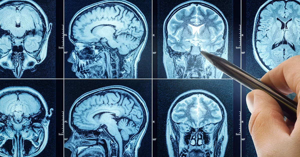 El cerebro, una red compleja que consume tanta energía como una bombilla