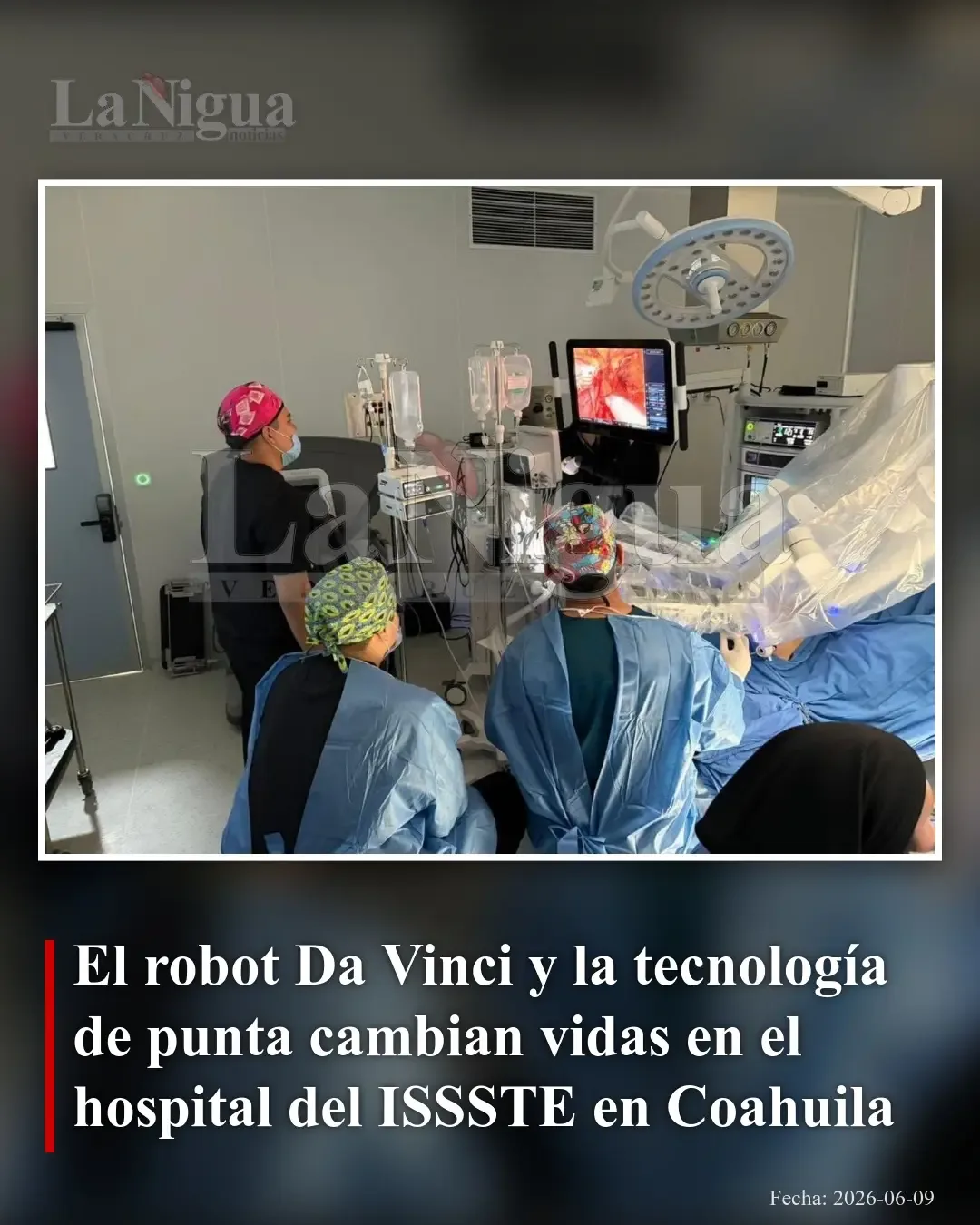 El robot Da Vinci revoluciona cirugías en el Hospital del ISSSTE en Coahuila
