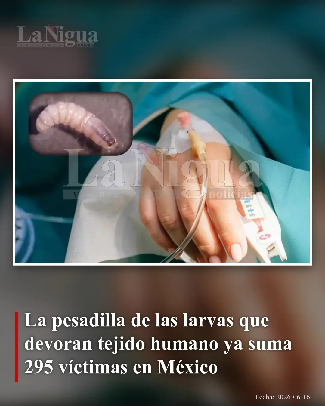 México enfrenta un aumento preocupante de casos de miasis causada por larvas que afectan tejidos humanos