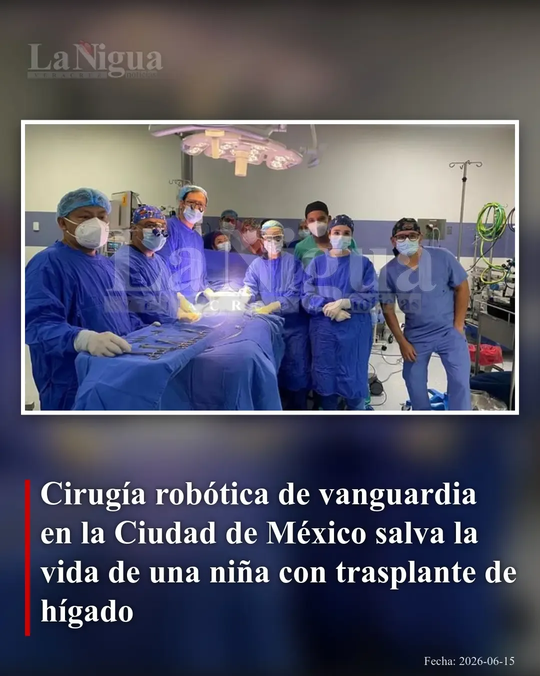 Trasplante hepático pediátrico pionero en México con cirugía robótica salva una vida