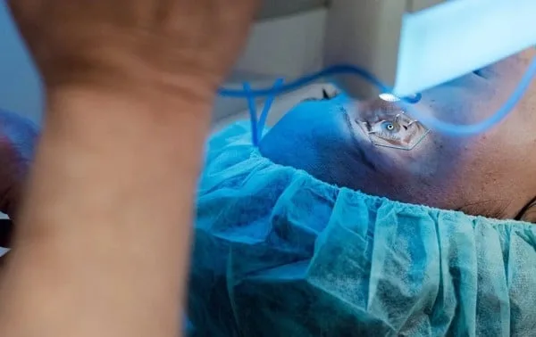 Un innovador procedimiento láser cambia el color de los ojos sin modificar el iris
