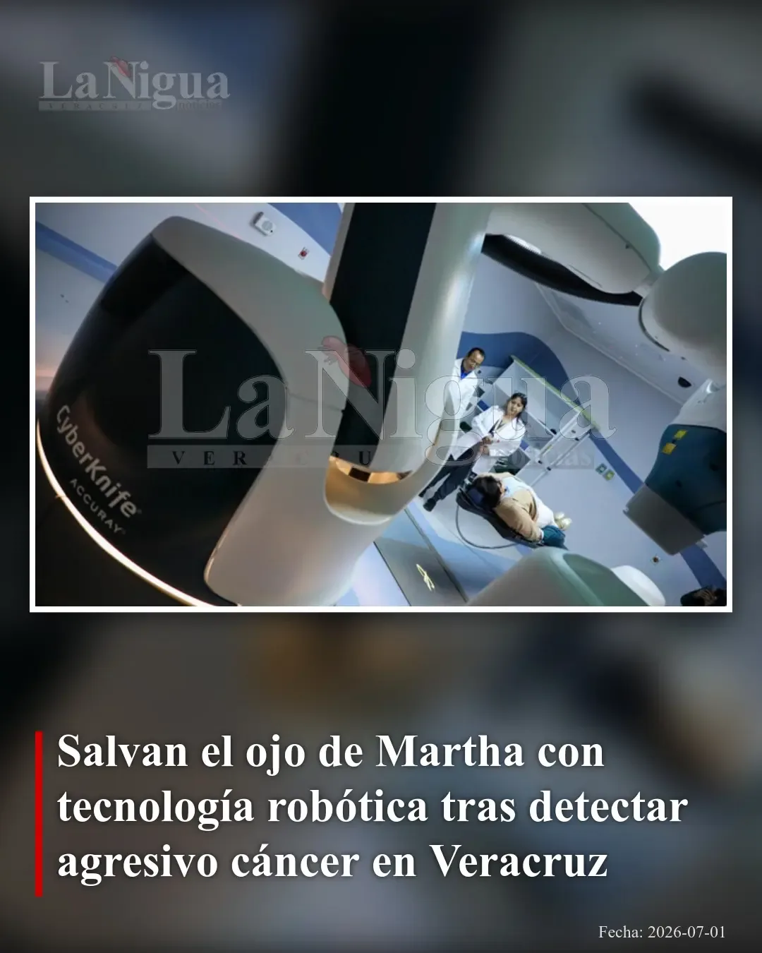 Tecnología robótica salva el ojo de mujer con cáncer ocular agresivo en Veracruz